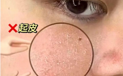化完妝后臉上起皮怎么補(bǔ)救？